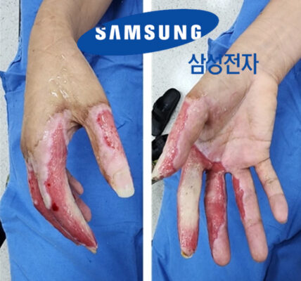 삼성전자 기흥사업장 방사선 피폭 사고, 노동자 삶 송두리째 앗아가