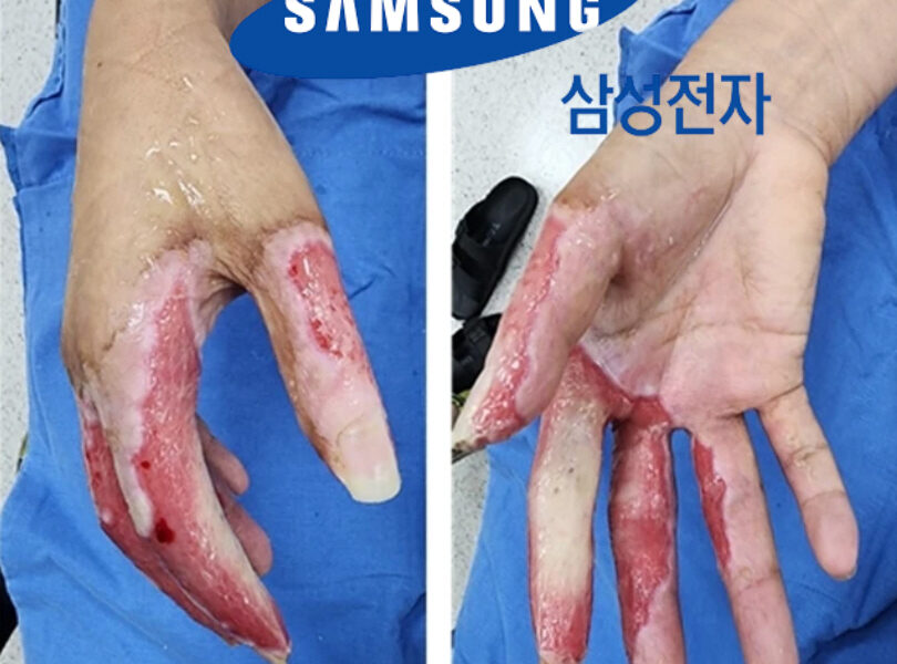 삼성전자 기흥사업장 방사선 피폭 사고, 노동자 삶 송두리째 앗아가