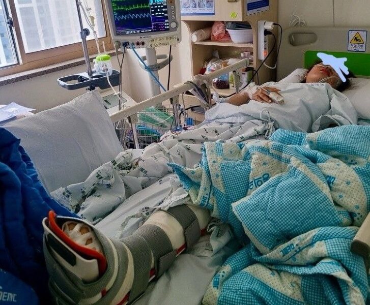 단속 과정에서 중상을 입고 병원을 전전하며 치료 중인 베트남 국적의 32세 여성 B씨. 요추와 발목, 족부에 다발성 골절을 입고 부산 소재 병원 중환자실까지 옮겨져 수술을 받았으며, 이후 수두까지 발병해 4월 4일 퇴원 후 경산 자택에서 자가격리 중이다. 총 치료비는 약 3,200만 원 중 2,300만 원을 본인이 부담했다.